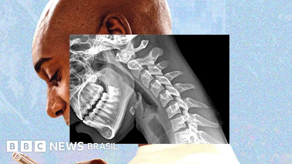Mãos fracas e visão turva: o alerta sobre “corpo de celular”